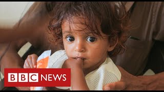 Yemen facing world’s “worst famine in decades”  BBC News [upl. by Lissie]