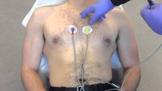 12 Lead ECG Placement example [upl. by Chuck]