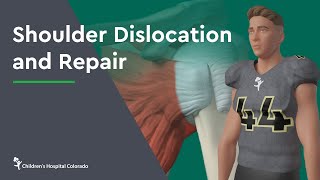 Traumatic Knee Dislocation ReductionQuick Version [upl. by Amles]