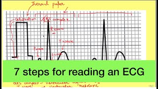 ECGEKG Interpretation Tutorial  Episode 1  Basic Principles [upl. by Anella]