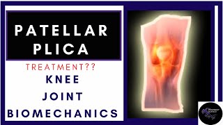 patellar plica syndrome treatment biomechanics explained physiotherapy tutorials [upl. by Annmaria]