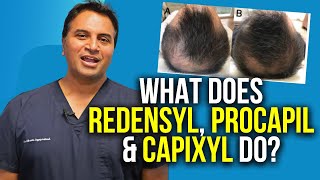 Redensyl Procapil and Capixyl For Hair Growth [upl. by Tanberg]