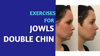 Double Chin Jowls Exercises  Before and After [upl. by Cita]