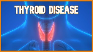 Hyperthyroidism vs Hypothyroid RN LPN NCLEX [upl. by Gruver]