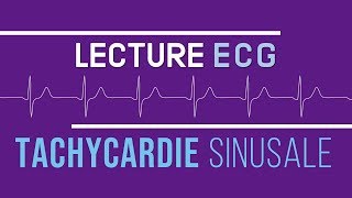 Interprétation ECG  Tachycardie Sinusale [upl. by Ttennaj]