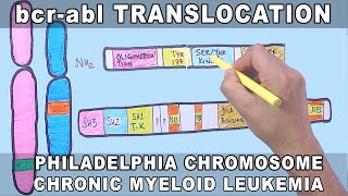 bcrabl Translocation Mechanism  Philadelphia Chromosome [upl. by Conley]