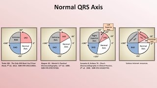 Intro to EKG Interpretation  Rate and Axis [upl. by Natalya252]