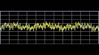 Inflammation  Rife Frequencies [upl. by Eisenhart]