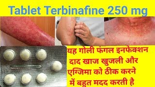 Tablet Terbinafine 250 Mg Full Review In Hindi  Uses  Dose  Side Effects Tarbinafine Tablet Uses [upl. by Ydnil580]