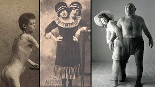 The Dark History of FREAK SHOWS [upl. by Flinn124]