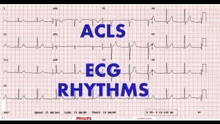 ACLS  ECG rhythm recognition amp management Part 1 [upl. by Htebasile]