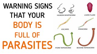 Dont Ignore These Early Symptoms Of Parasites In Your Body [upl. by Kneeland]