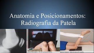 Anatomia Radiográfica Patela PA Perfil Settegast Hughston Merchant Hobbs [upl. by Stoller]