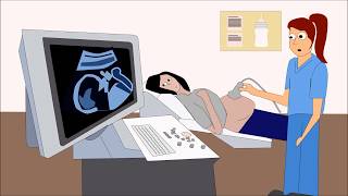 PreEclampsia 10 FACTS YOUR OBGYN WANTS YOU TO KNOW about high blood pressure in pregnancy PART 1 [upl. by Eniotna496]