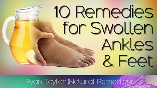 10 Home Remedies for Swollen Feet and Ankles [upl. by Acenahs]