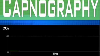 EtCO2 Capnography Part 2 [upl. by Netram640]