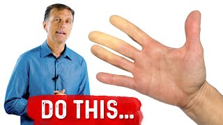 Raynauds Syndrome – What Can you do for Raynauds Syndrome – DrBerg [upl. by Argella]