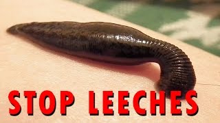 How to stop Leeches [upl. by Cherilynn]