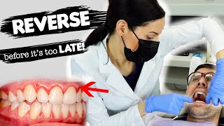 How To Treat Gum Disease [upl. by Burgess]