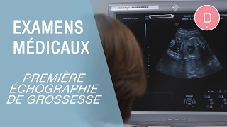 La première échographie de grossesse  Examens grossesse [upl. by Aiem425]