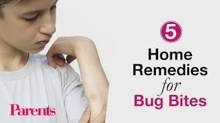 Home Remedies for Bug Bites  Parents [upl. by Edette]