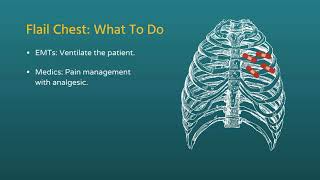 Chest Trauma Flail Chest [upl. by Annahs]