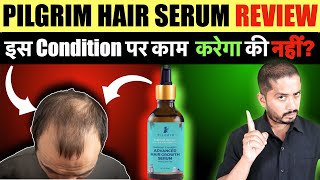 Pilgrim Advanced Hair Growth Serum Review  Genuine Tips [upl. by Nakasuji892]