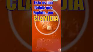 La célula que explota…por CLAMIDIA [upl. by Ydasahc]