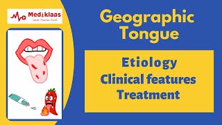 Geographic tongue Benign Migratory Glossitis [upl. by Diego]