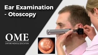 Otoscopy Ear Examination  ENT [upl. by Haldis]