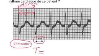 Exploiter un ECG [upl. by Inattirb]