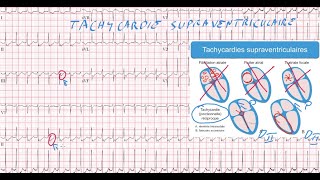 20 ECG  Quiz  Dr Synapse [upl. by Redna882]