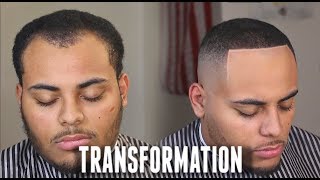 HAIRCUT TRANSFORMATION  Receding Hairline amp Widows Peak Tips HD [upl. by Vezza]