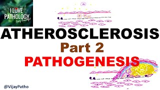 ATHEROSCLEROSIS  Part 2 Pathogenesis [upl. by Acireed840]