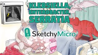 Klebsiella Enterobacter Serratia  SketchyMicro  Sketchy Medical USMLE Step 1 [upl. by Christophe771]