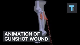 Animation of gunshot wound [upl. by Nylahsoj]