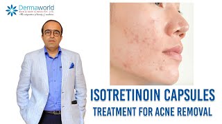 Isotretinoin capsules  Treatment for Acne removal  In Hindi  Dr Rohit Batra [upl. by Medora490]