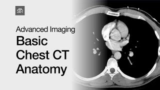 Advanced Imaging Basic Chest CT Anatomy [upl. by Noryk]