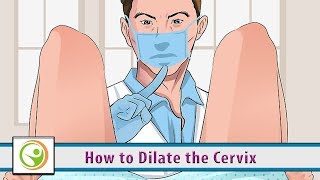 How to Dilate the Cervix [upl. by Trebron]