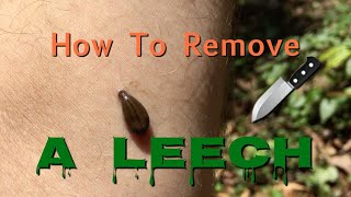 How To Remove A Leech [upl. by Soirtimid725]