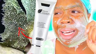 THE VIRAL GREEN TEA CLEANSING MASK WORTH THE HYPE Dr Sugarm Peeling Mask [upl. by Ahmad]