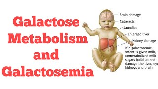 Galactose metabolism  Biochemistry [upl. by Ilenna]