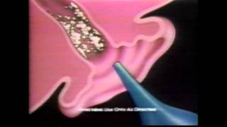 Murine Earwax Removal 1990 [upl. by Fridlund557]