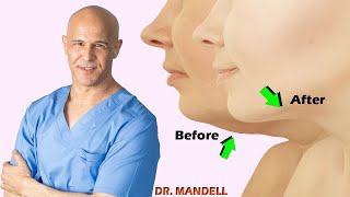 Simple Jawline Exercises to Remove Double Chin  Dr Alan Mandell DC [upl. by Goles]