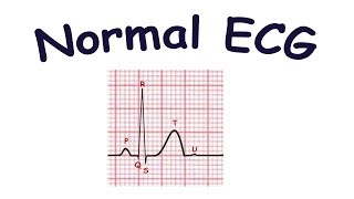 Normal ECG [upl. by Nerraw]