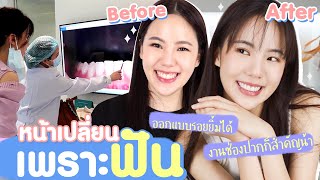 หน้าเปลี่ยนเพราะสิ่งนี้  เชื่อเจนเหอะ EP 2 l JANISTAR [upl. by Airdnekal577]