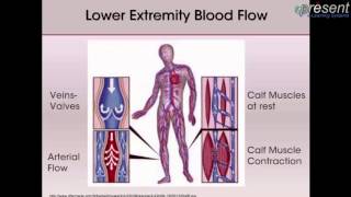 Venous Leg Ulcers Pathophysiology and Assessment [upl. by Fennell930]