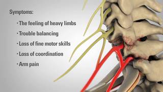 Cervical Plexus  Anatomy Tutorial [upl. by Mitch]