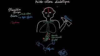 Acidocétose diabétique  Clinique  Diagnostique  Prise en Charge  Partie 2  Docteur Synapse [upl. by Gilberte]