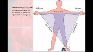 12 Lead Interpretation Part 1 Introduction to the 12 Lead EKG [upl. by Eileme]